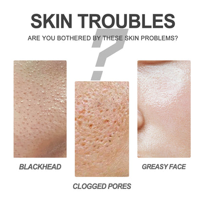 EELHOE Blackhead Cleansing Cream Skin Oil Blackheads 